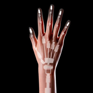 Anti-puncture finger